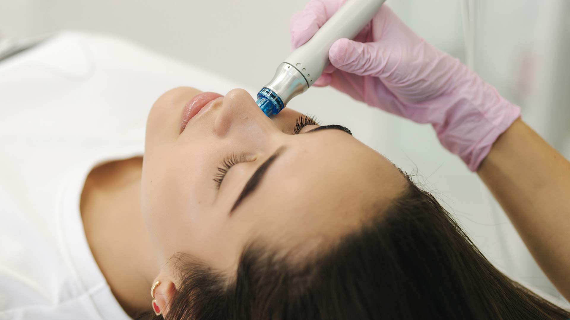 Microneedling