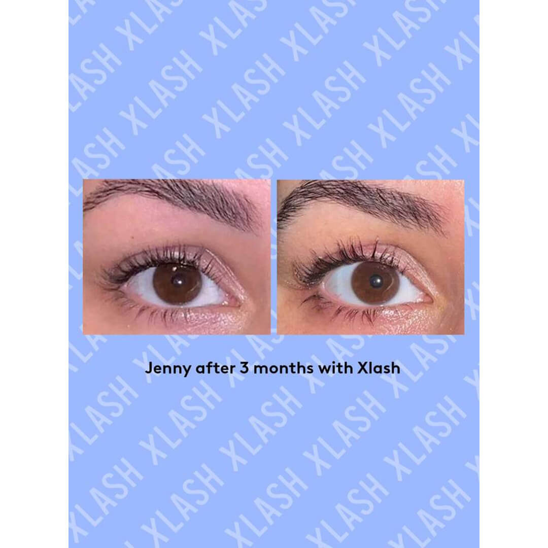 Xlash Eyelash Serum 3 ml