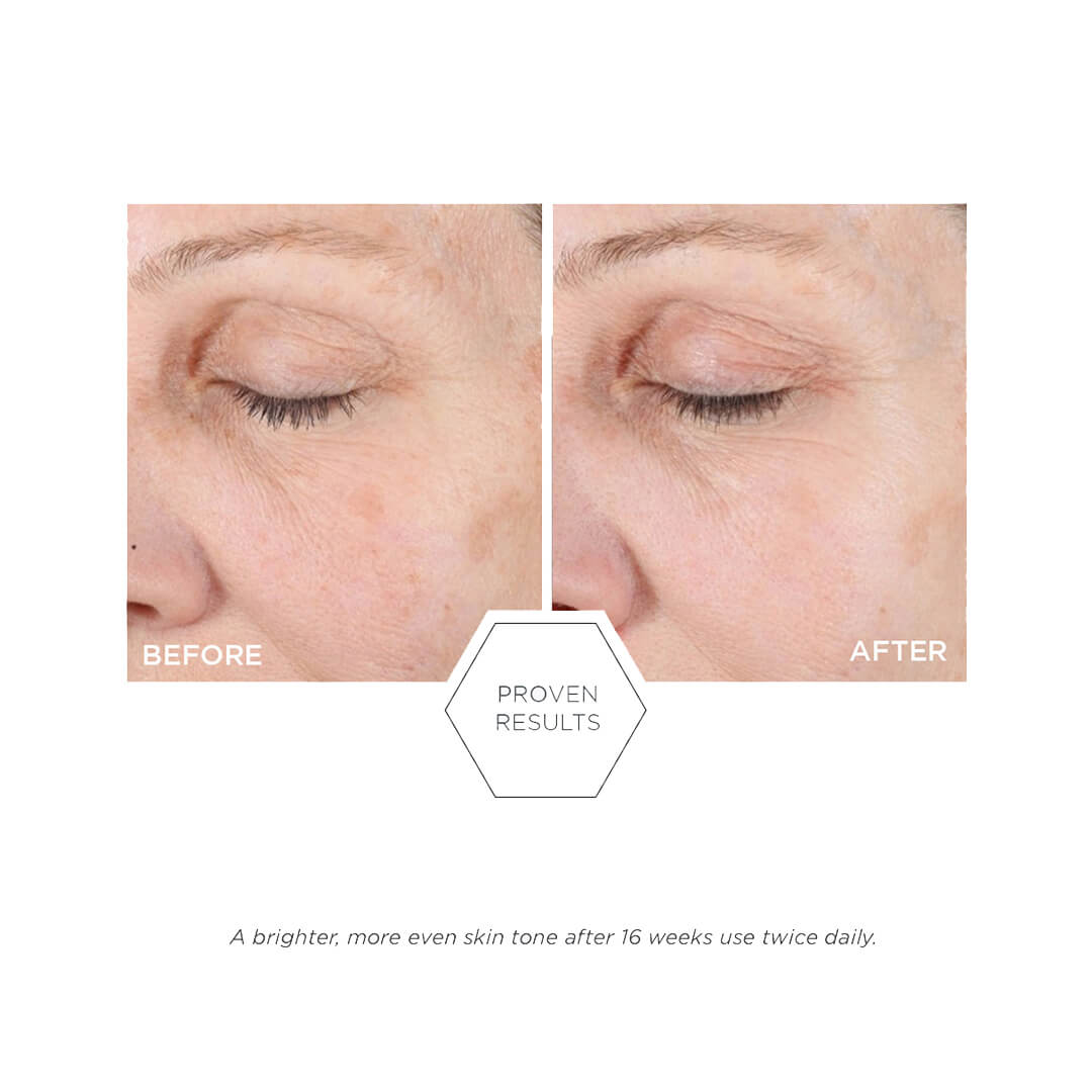 Neostrata Ultra Brightening Cleanser 100 ml