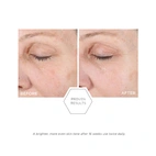 Neostrata Ultra Brightening Cleanser 100 ml