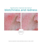 Neostrata Redness Neutralizing Serum 29g