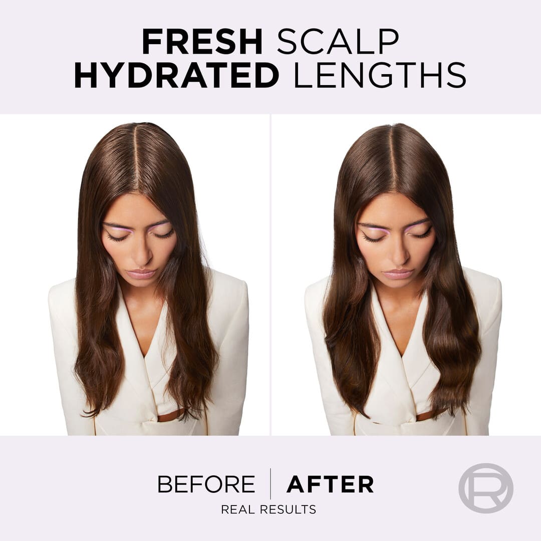 Loreal Paris Elvital Hyaluron Pure Oil Erasing Scalp Serum 102 ml