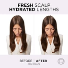 Loreal Paris Elvital Hyaluron Pure Oil Erasing Scalp Serum 102 ml
