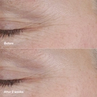 Clinique Smart Clinical Repair Am Pm Retinoid Balm 3g