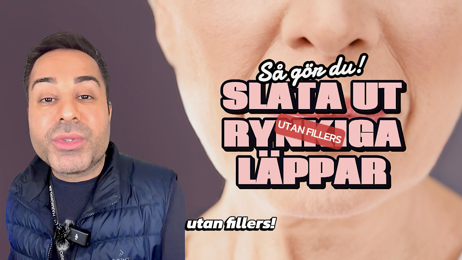 Rynkiga läppar efter 40+