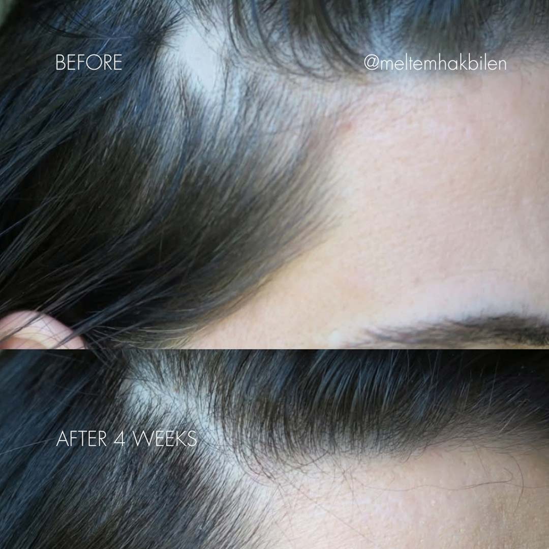 Sweed The Hair Serum 6 ml