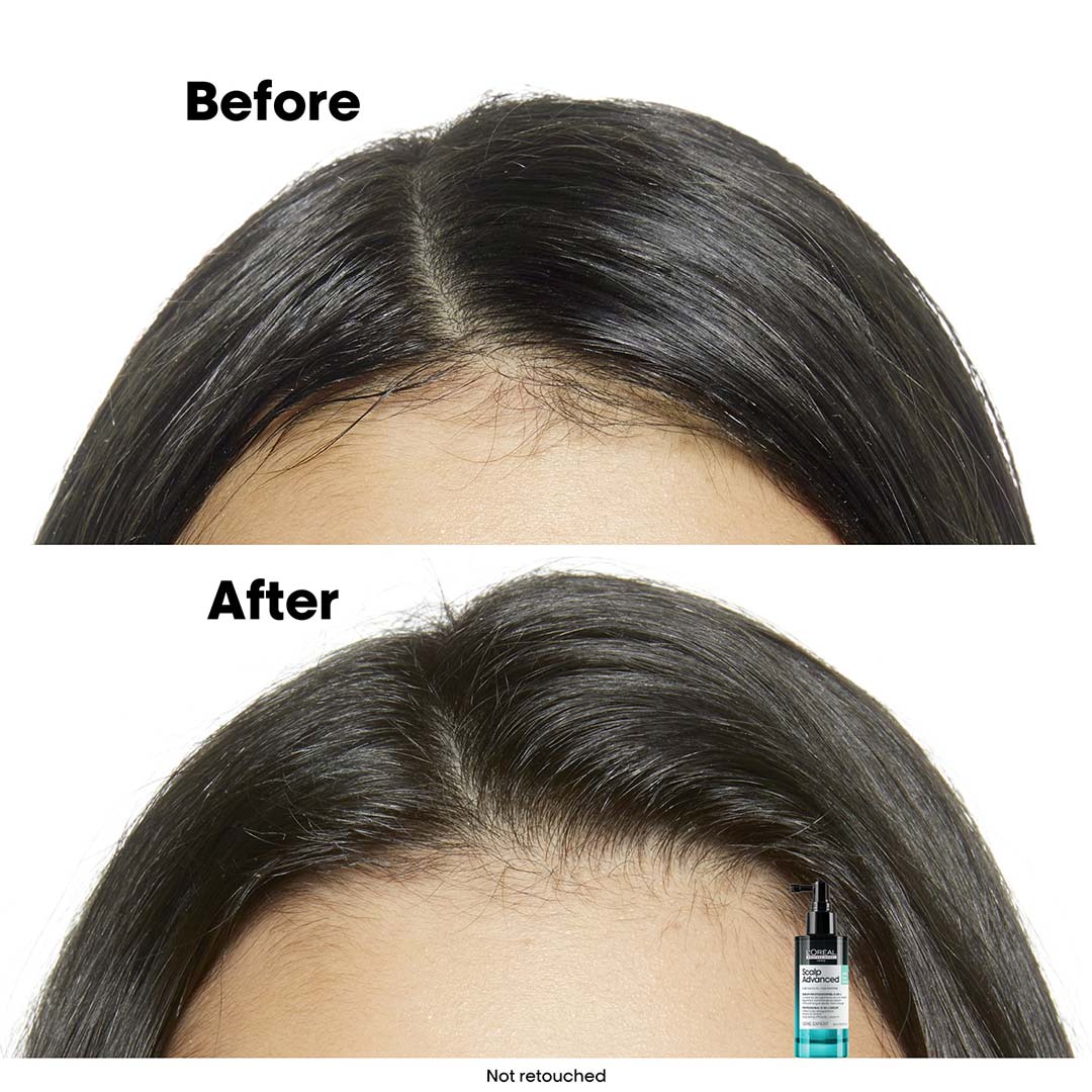 L'Oréal Professionnel Scalp Advanced Anti-Discomfort Shampoo 500 ml