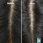 L'Oréal Professionnel Scalp Advanced Anti-Dandruff Shampoo 300 ml