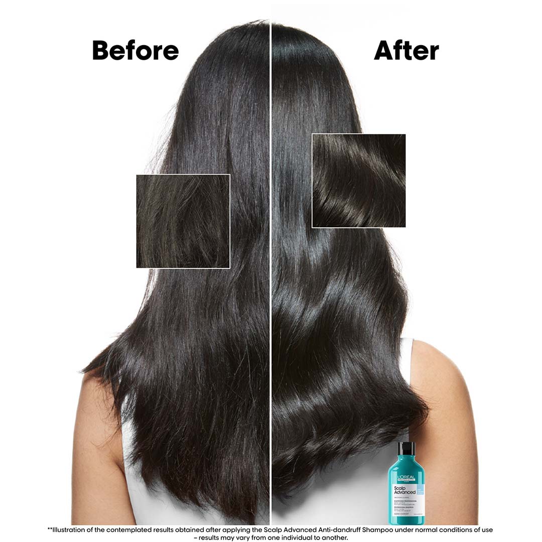 L´Oréal Professionnel Scalp Advanced Anti-Dandruff Shampoo 300 ml