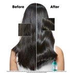 L´Oréal Professionnel Scalp Advanced Anti-Dandruff Shampoo 300 ml