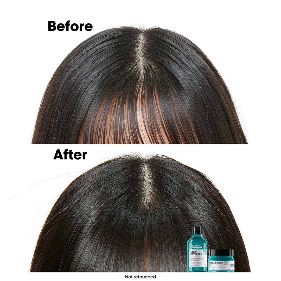 L'Oréal Professionnel Scalp Advanced Anti-Oiliness 2-In-1 Deep Purifying Clay 250 ml