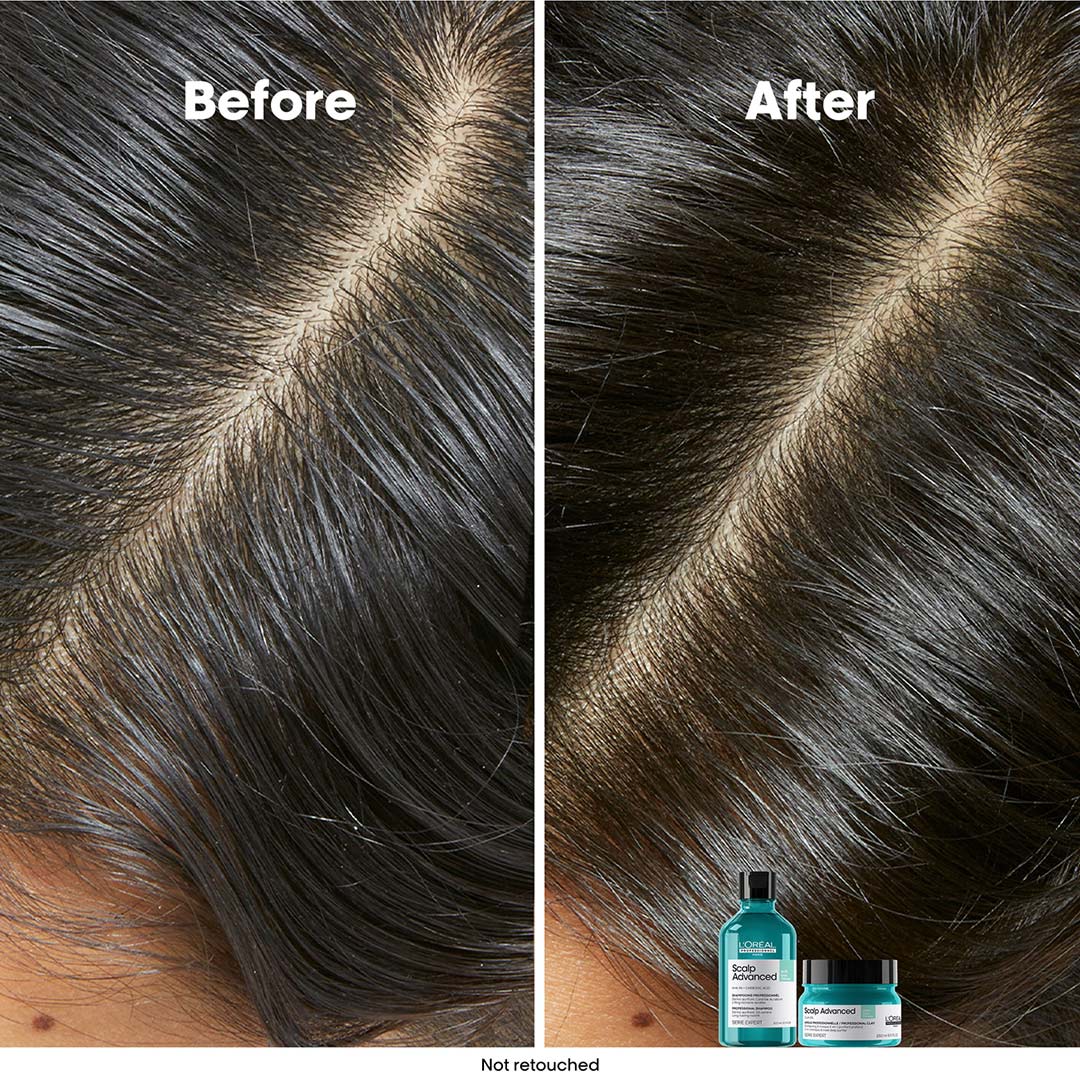 L´Oréal Professionnel Scalp Advanced Anti-Oiliness Shampoo 300 ml