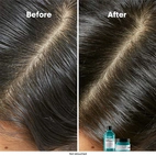L´Oréal Professionnel Scalp Advanced Anti-Oiliness Shampoo 300 ml