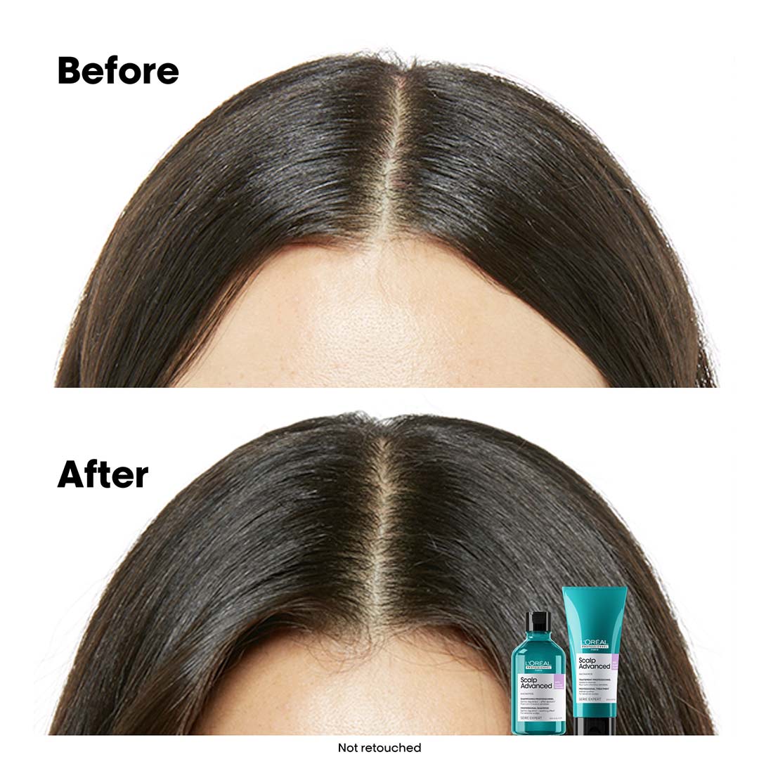 Loreal Professionnel Scalp Advanced Anti-Discomfort Shampoo 300 ml