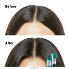 L'Oréal Professionnel Scalp Advanced Anti-Discomfort Shampoo 300 ml