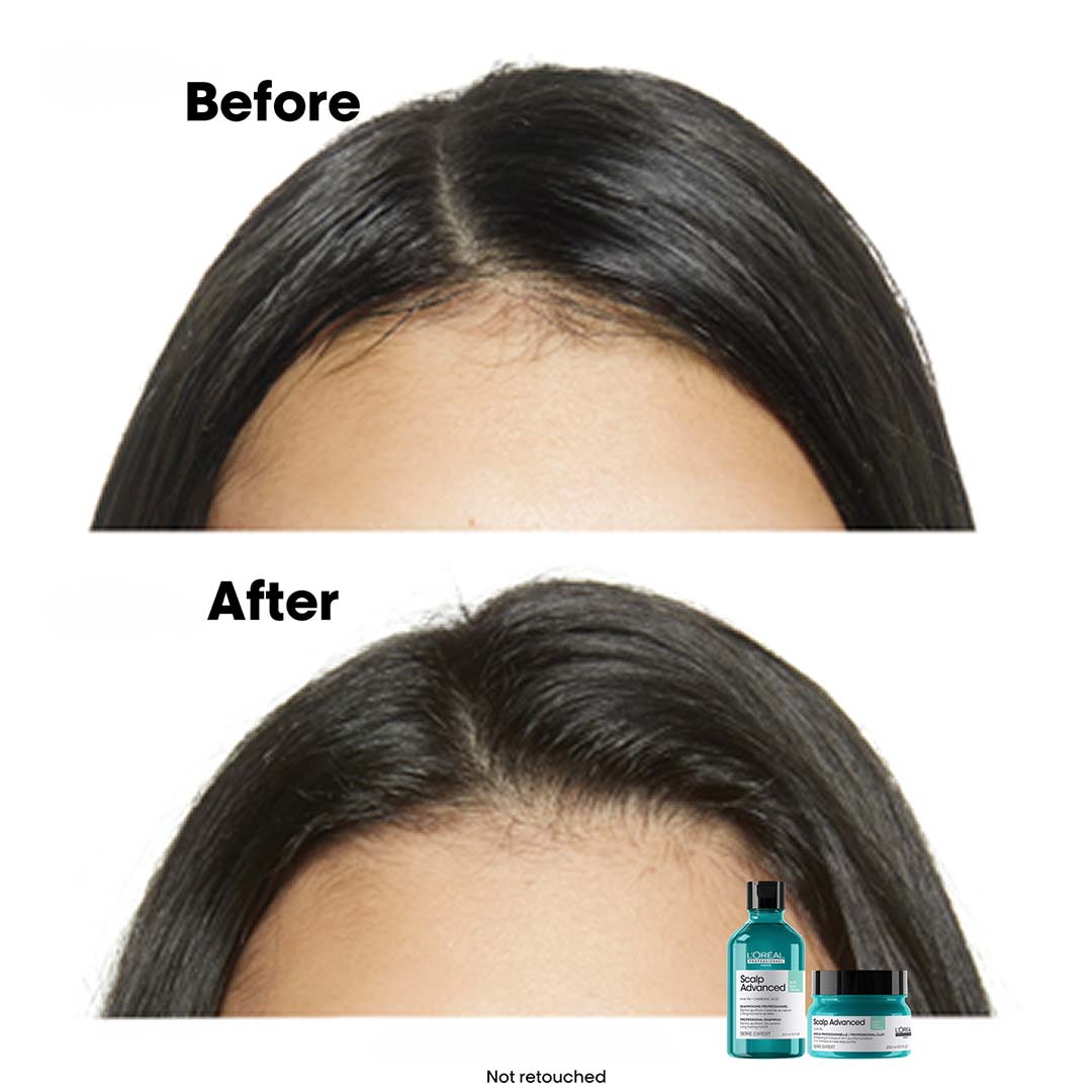 L´Oréal Professionnel Scalp Advanced Anti-Oiliness Shampoo 300 ml