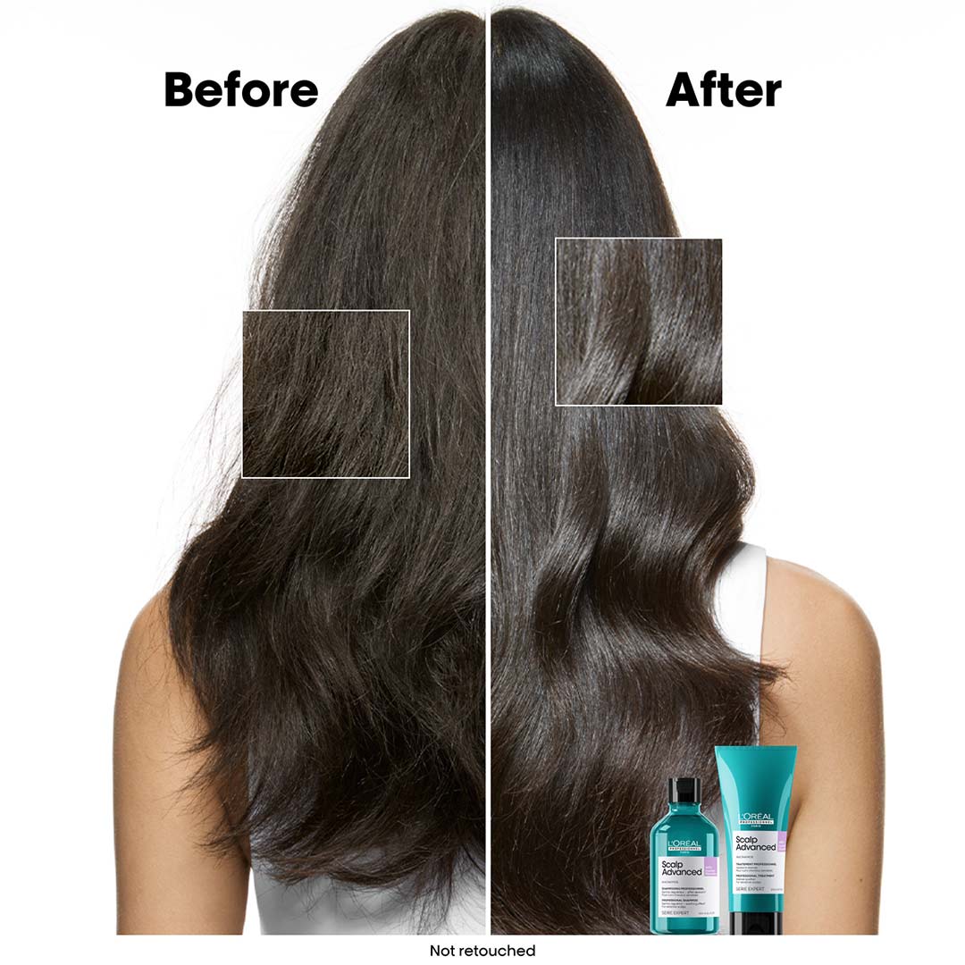 L´Oréal Professionnel Scalp Advanced Anti-Discomfort Shampoo 300 ml
