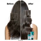 L'Oréal Professionnel Scalp Advanced Anti-Discomfort Shampoo 300 ml