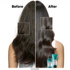 L´Oréal Professionnel Scalp Advanced Anti-Discomfort Shampoo 300 ml