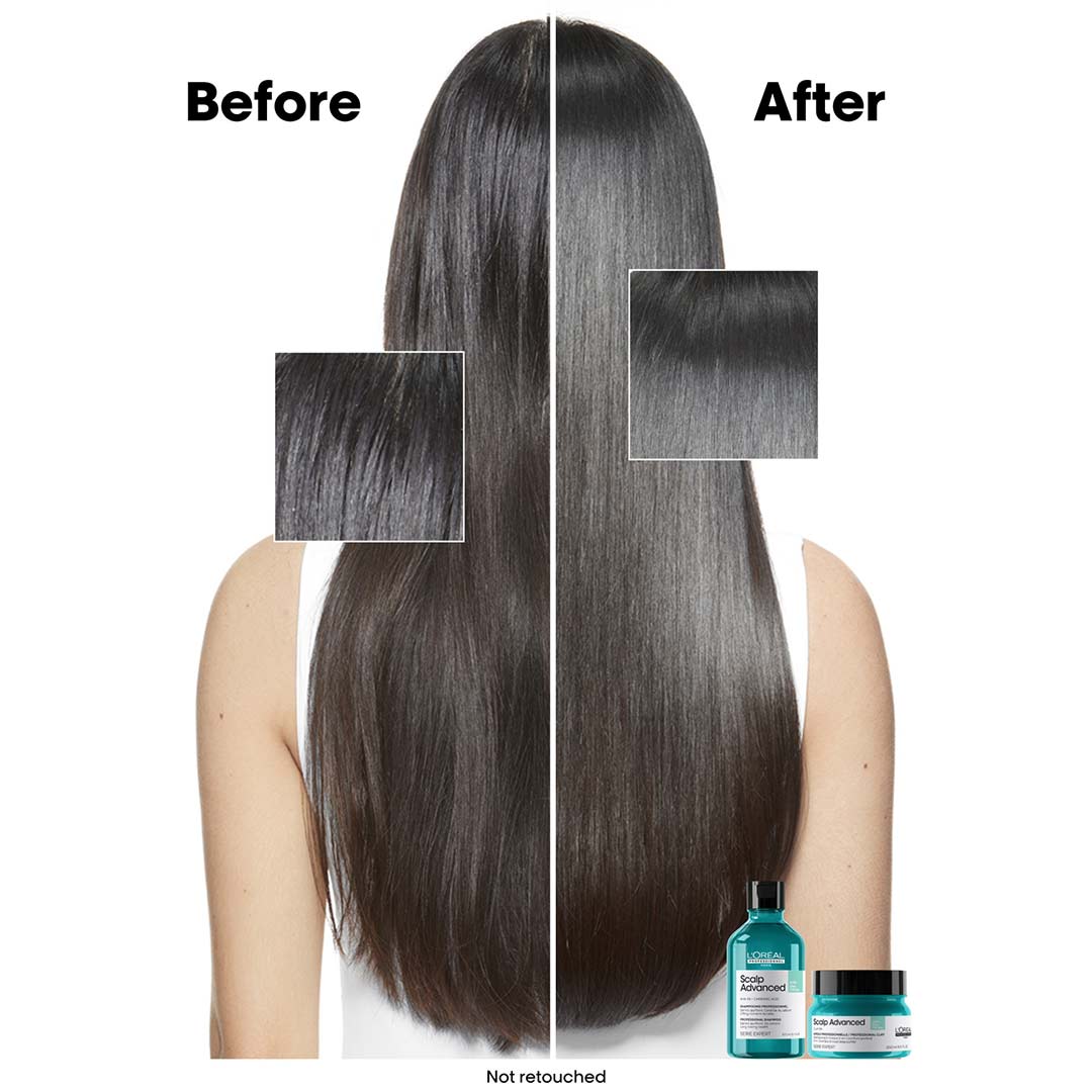 L'Oréal Professionnel Scalp Advanced Anti-Oiliness Shampoo 300 ml