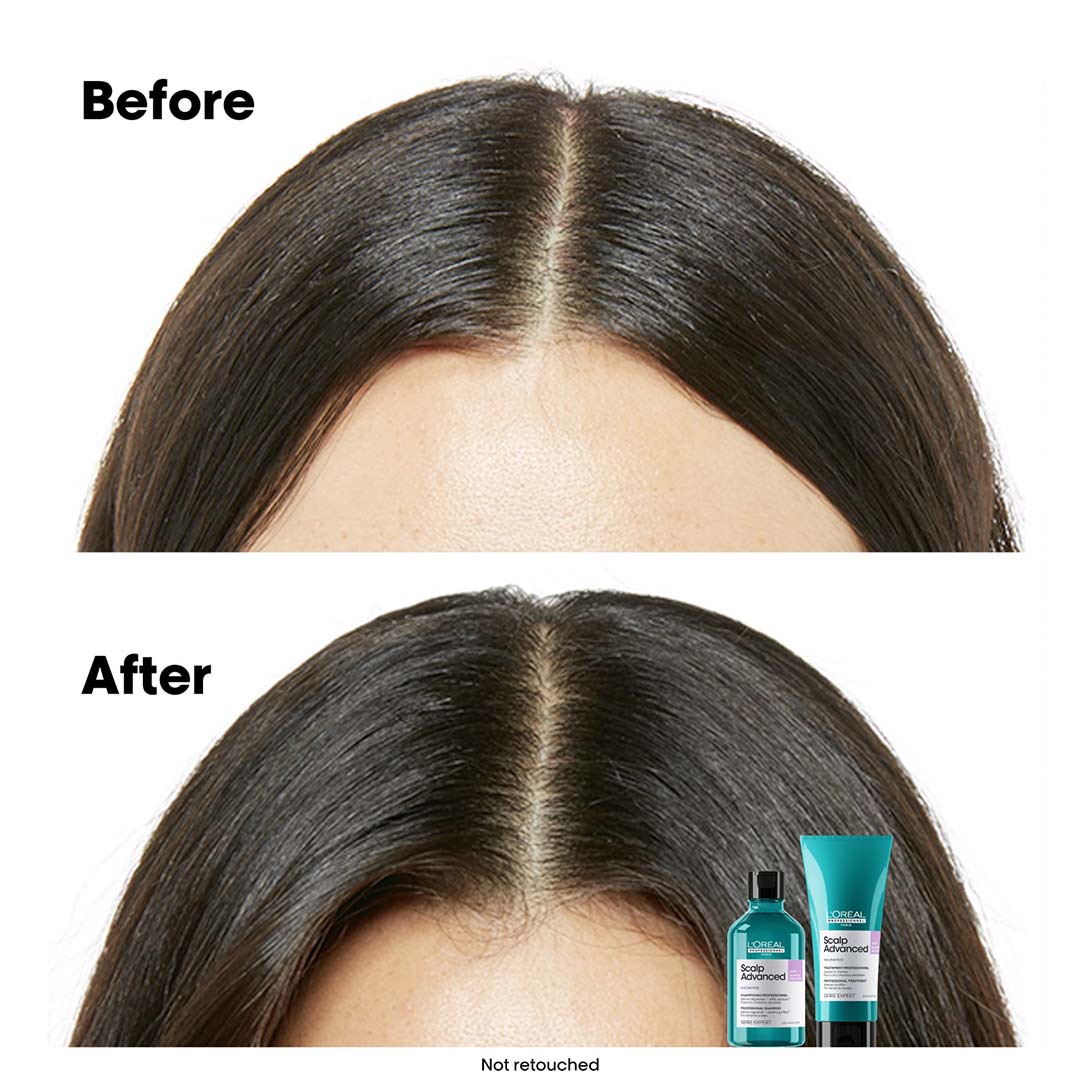 L´Oréal Professionnel Scalp Advanced Discomfort Shampoo Refill 500 ml