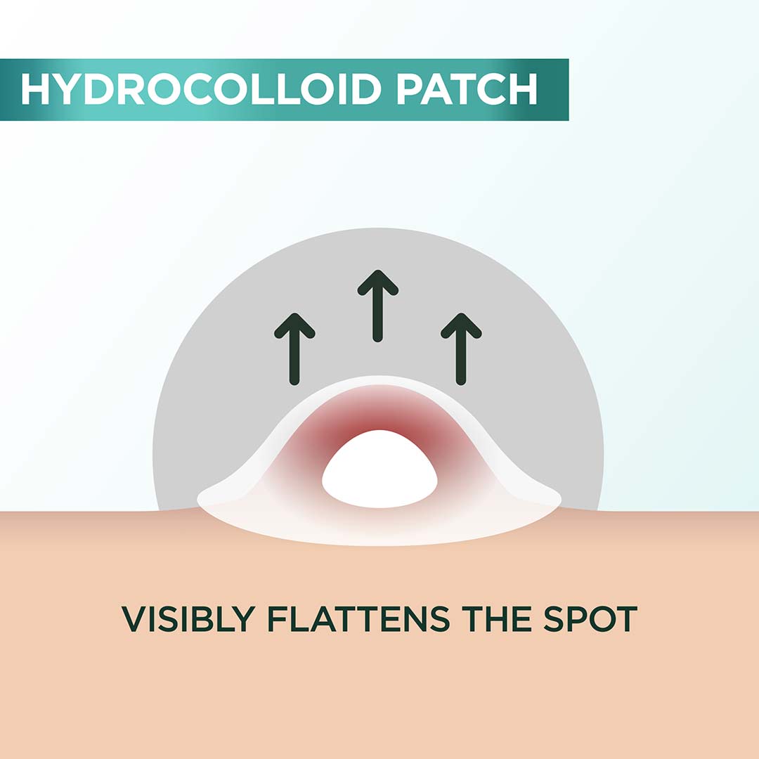 Garnier Pureactive Pimple Patch 22pcs